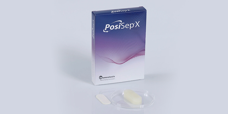 Why Hemostasis PosiSep X Stands Out From Other Nasal Hemostasis Products
